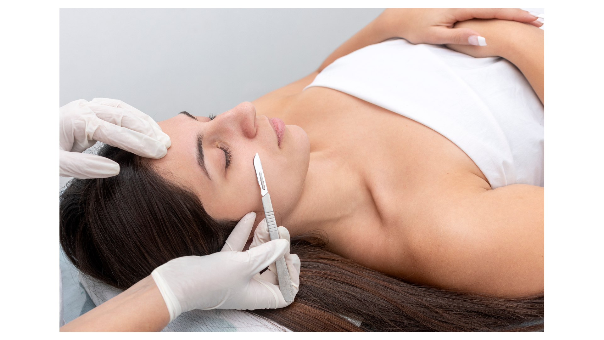 dermaplaning